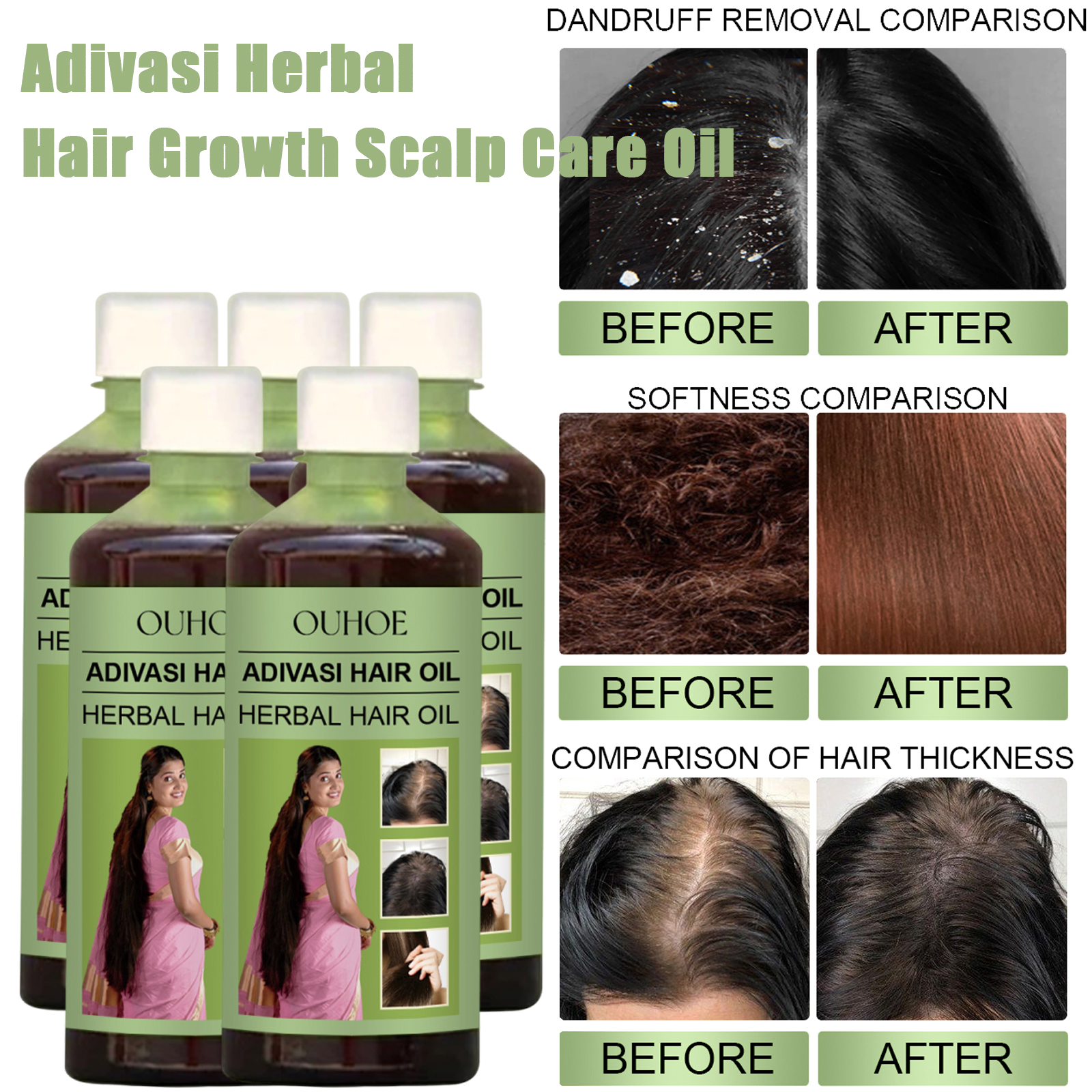 Hair Care Ouai - 100ml Hair Growth Oil India Adivasi