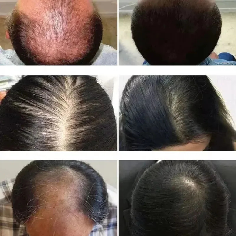 Rosemary Hair Growth Oil Anti  - Hair Care Ouai avaliação e preço