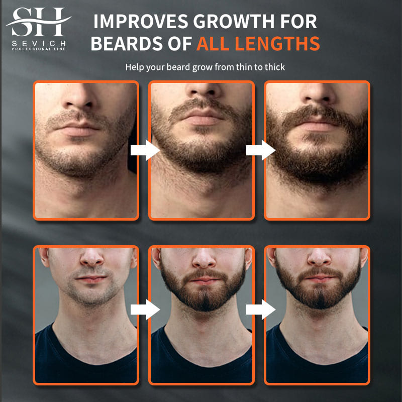 Sevich Men Beard Growth Essent - Hair Care Hair Serum avaliação e preço