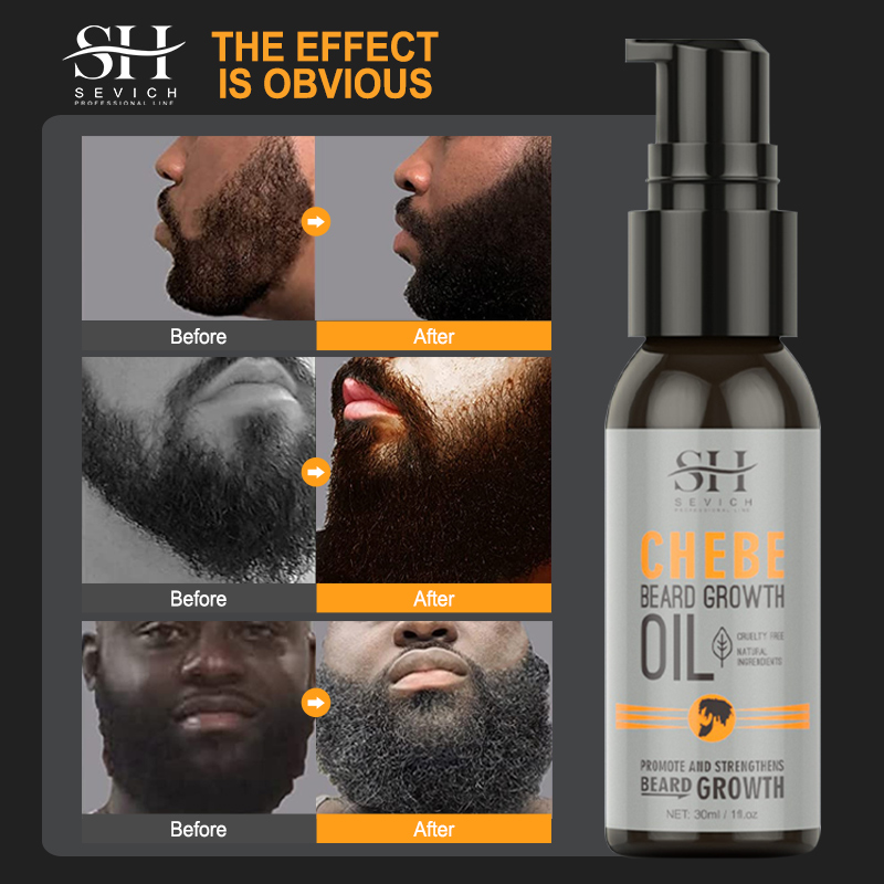 Sevich Men Beard Growth Essent - Hair Care Hair Serum avaliação e preço