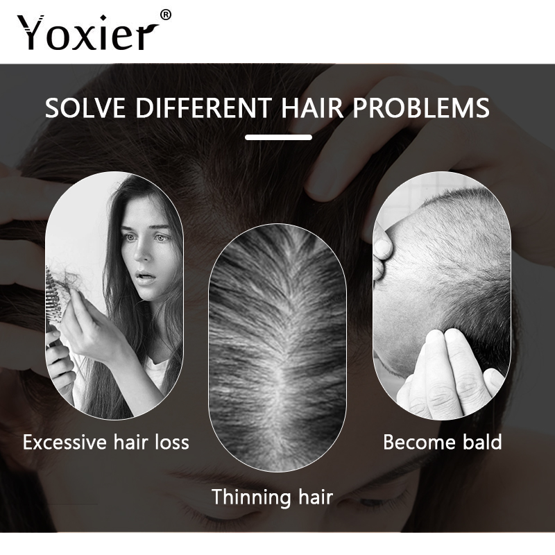 Intensive Growth Serum Prevent - Hair Care Hair Serum avaliação e preço