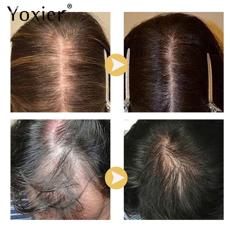Intensive Growth Serum Prevent - Hair Care Hair Serum avaliação e preço