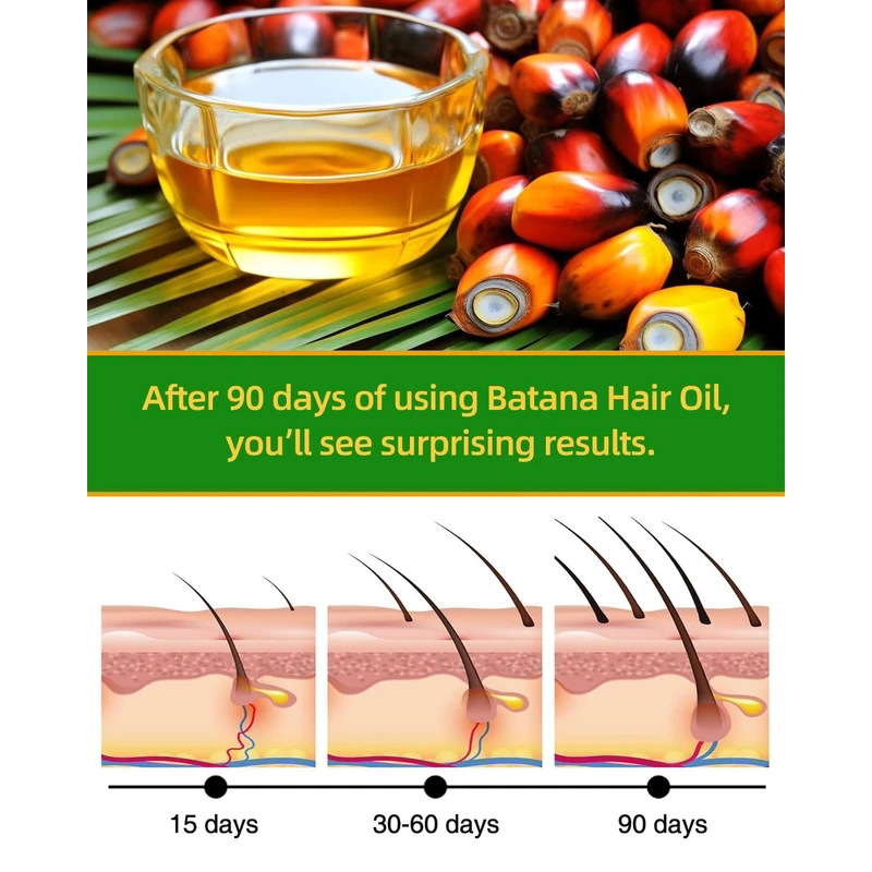 Batana Rosemary Hair Care Esse - Hair Care Essential Oil avaliação e preço