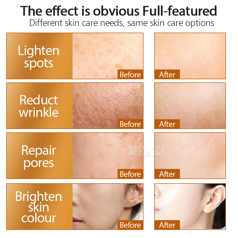 ZGTS 192pin Derma Roller Micro - Hair Care Tips avaliação e preço