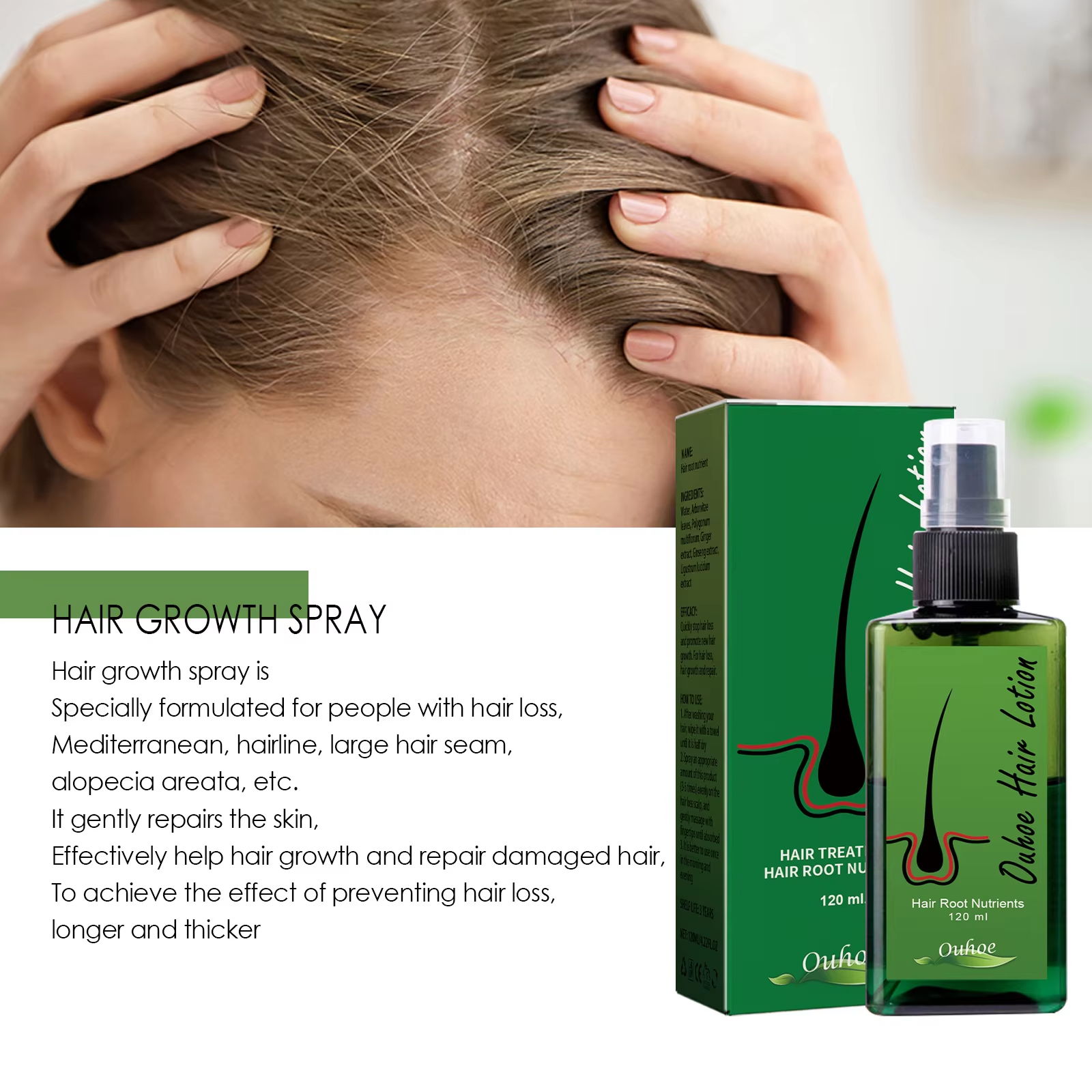 Hair Growth Spray Anti Hair Lo - Hair Care Essence avaliação e preço